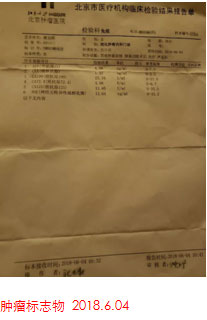 日本細胞免疫治療患者案例圖1