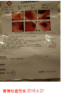 日本細胞免疫治療患者案例圖2