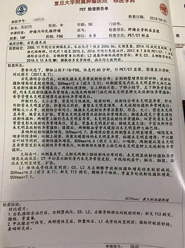 日本細胞免疫治療患者案例圖5