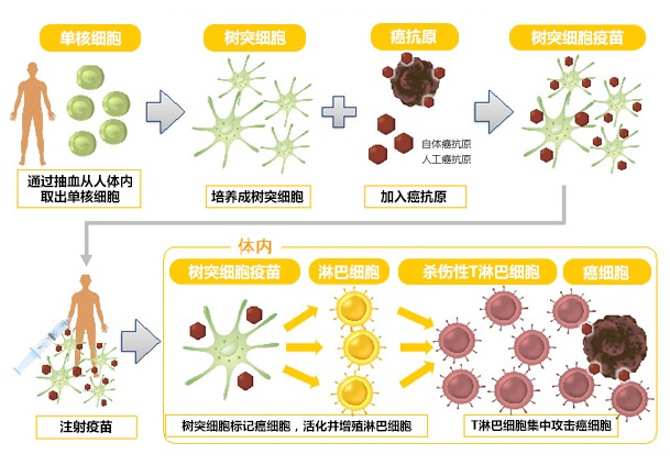樹突細(xì)胞疫苗治療流程